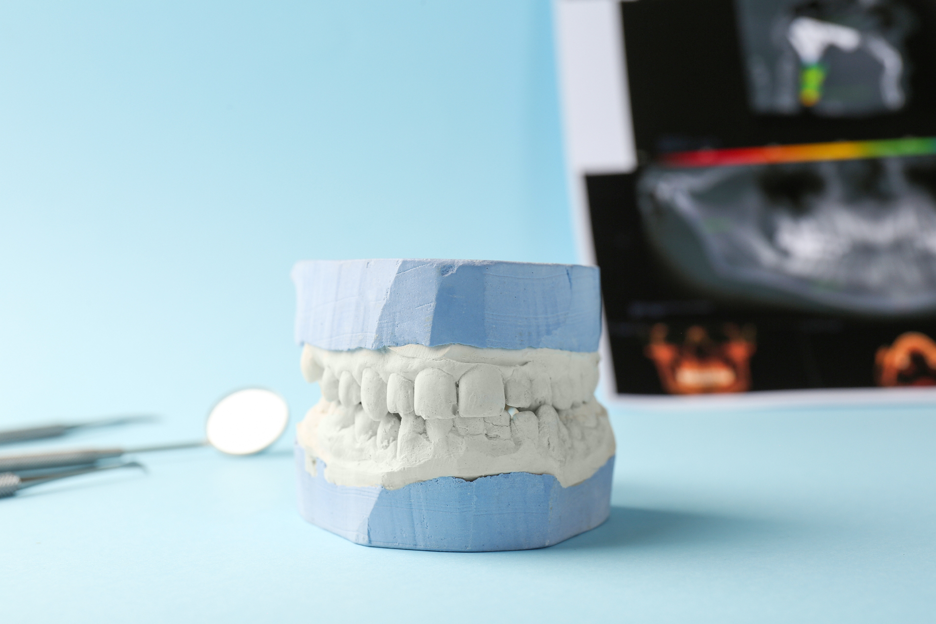 Dental implant plaster model with CBCT scan and dental tools